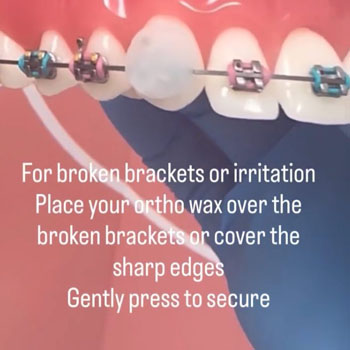 Marvel Orthodontics Instagram