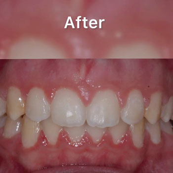 Marvel Orthodontics Instagram