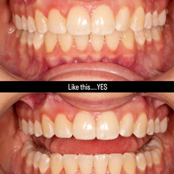 Marvel Orthodontics Instagram