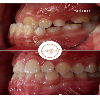 Marvel Orthodontics Instagram Marvel Orthodontics Instagram